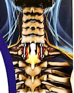 Spine illustration