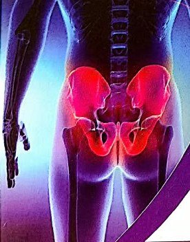 Pelvic X-ray